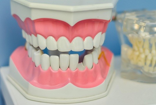 traitement dents élastiques