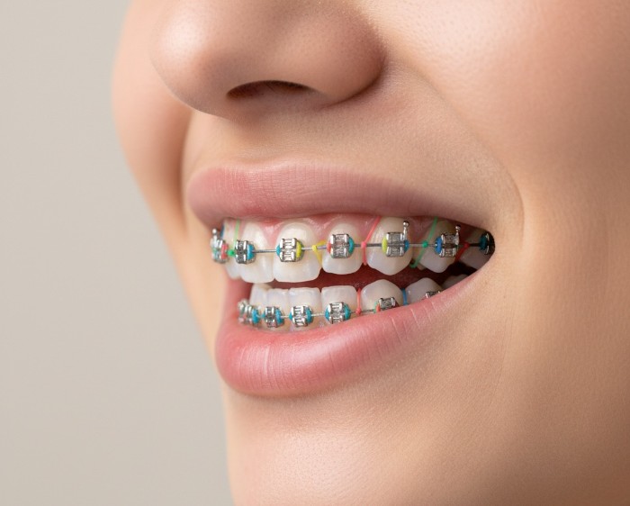 Nunc Volutpat Venenatis